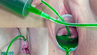 Japanese Lesbian'S Perversion Of Cervix And Urethral Injection For Pleasure